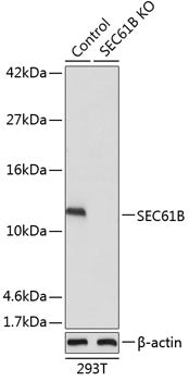 [KO Validated] SEC61B Rabbit pAb