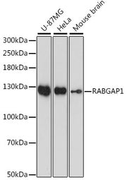 RABGAP1 Rabbit pAb