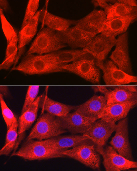 Galectin 1/LGALS1 Rabbit pAb