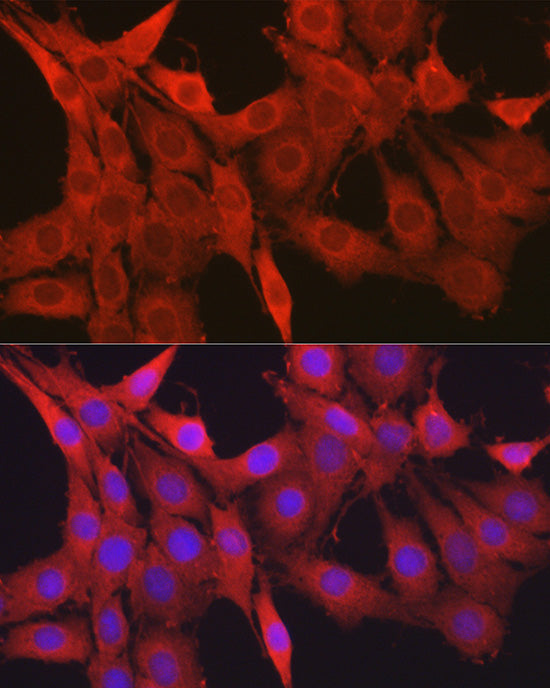 Galectin 1/LGALS1 Rabbit pAb