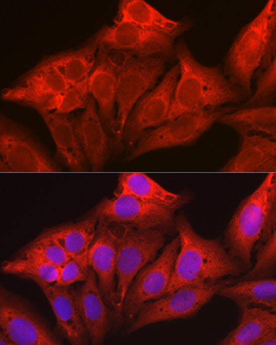 Galectin 1/LGALS1 Rabbit pAb