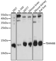 TIMM8B Rabbit pAb