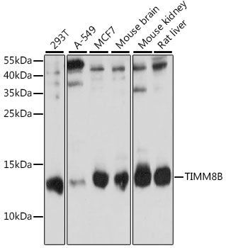 TIMM8B Rabbit pAb