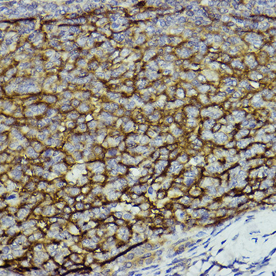 CD11b/ITGAM Rabbit pAb