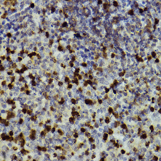 CD11b/ITGAM Rabbit pAb