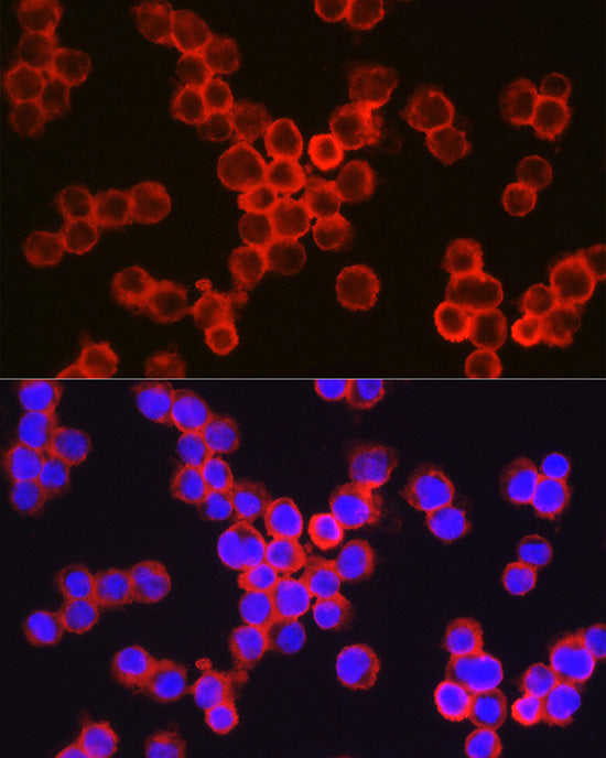 CD11b/ITGAM Rabbit pAb