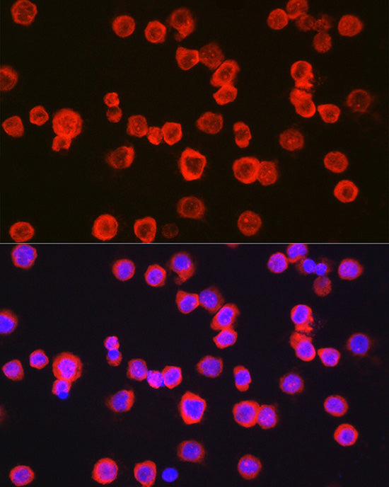 CD11b/ITGAM Rabbit pAb