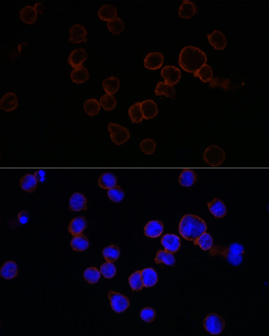 CD11b/ITGAM Rabbit pAb