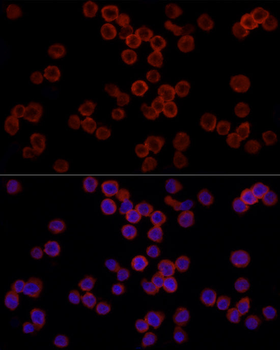 CD11b/ITGAM Rabbit pAb