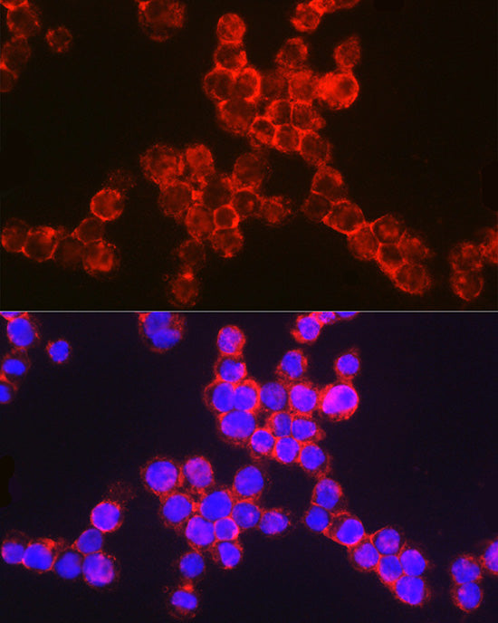 CD11b/ITGAM Rabbit pAb