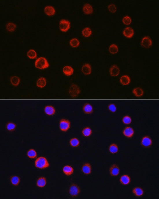 CD11b/ITGAM Rabbit pAb