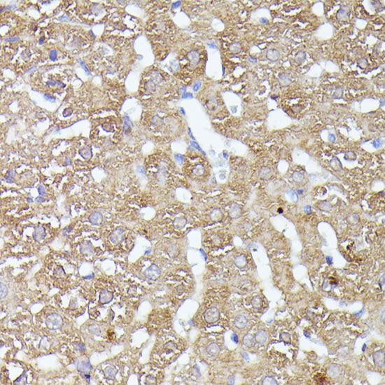 CDK5RAP1 Rabbit pAb