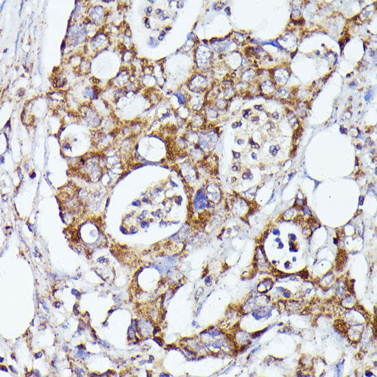 CDK5RAP1 Rabbit pAb