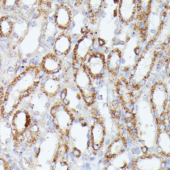 CDK5RAP1 Rabbit pAb