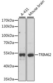 TRIM62 Rabbit pAb