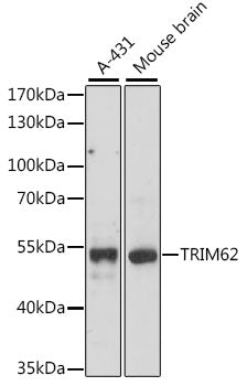 TRIM62 Rabbit pAb