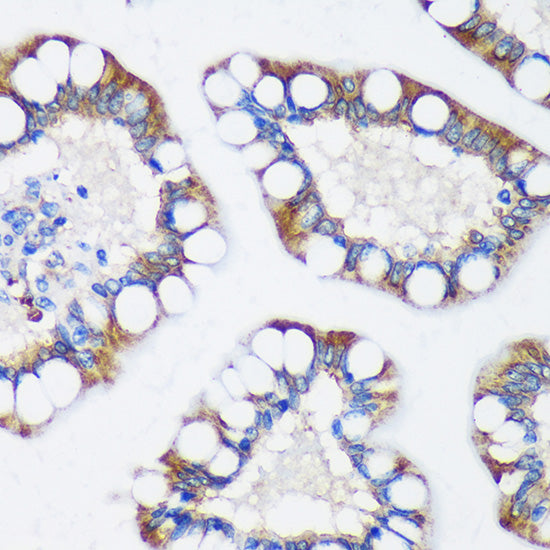 TRIM62 Rabbit pAb