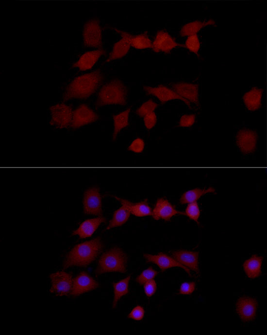 NGLY1 Rabbit pAb