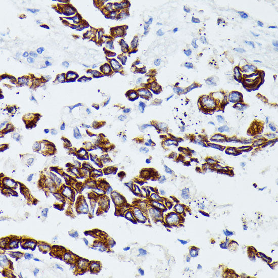 MMP25 Rabbit pAb