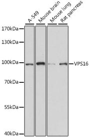 VPS16 Rabbit pAb