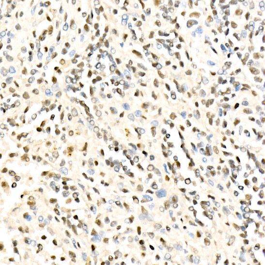 METTL16 Rabbit pAb