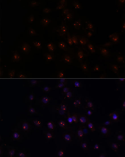 METTL16 Rabbit pAb