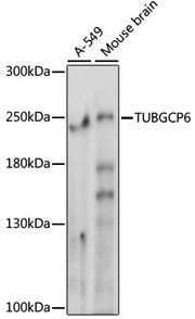 TUBGCP6 Rabbit pAb