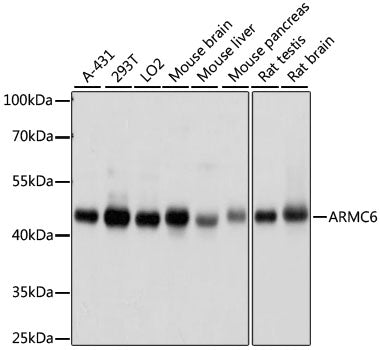 ARMC6 Rabbit pAb