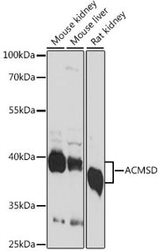 ACMSD Rabbit pAb