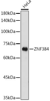 ZNF384 Rabbit pAb