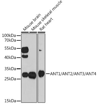 ANT1/ANT2/ANT3/ANT4 Rabbit pAb
