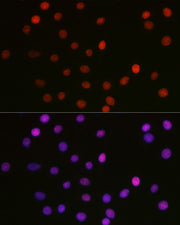 Acetyl-HMGB1-K29 Rabbit pAb