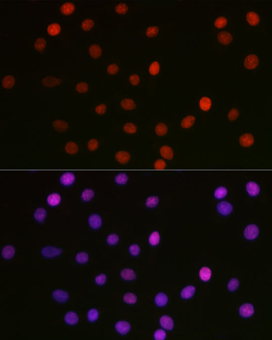 Acetyl-HMGB1-K29 Rabbit pAb