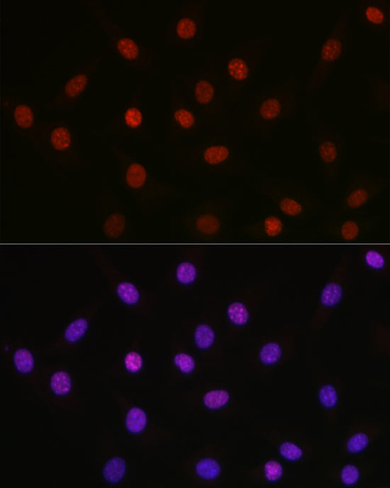 Acetyl-HMGB1-K29 Rabbit pAb