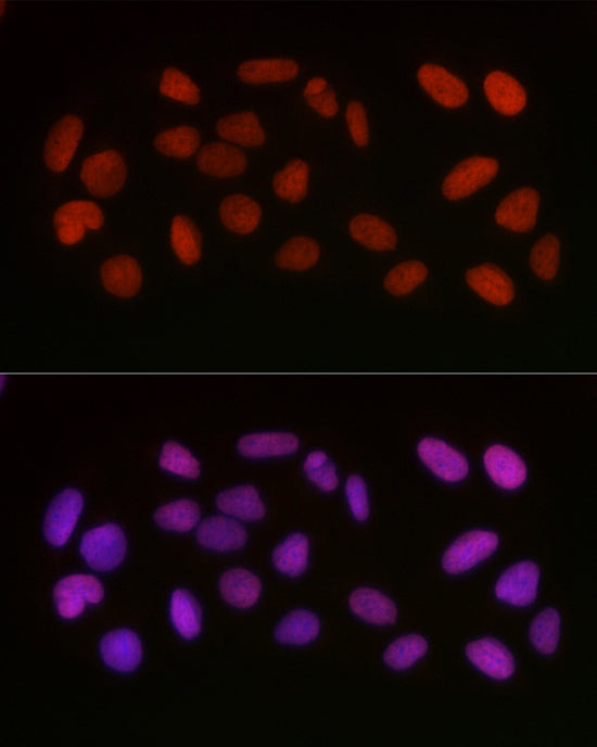 Acetyl-HMGB1-K29 Rabbit pAb