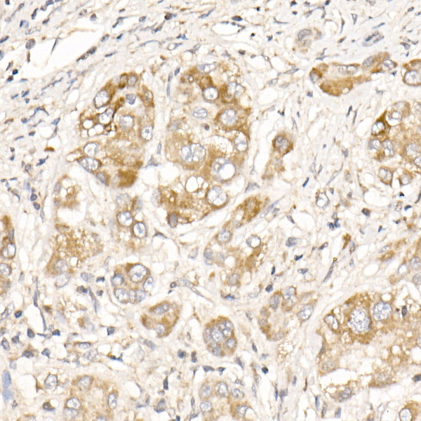 PGAM5 Rabbit pAb