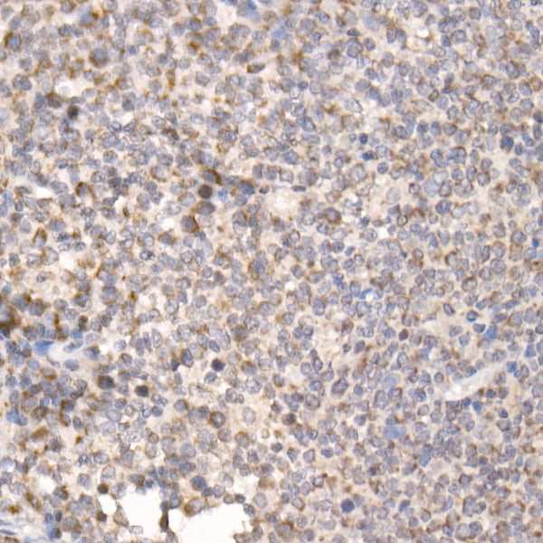 PGAM5 Rabbit pAb