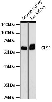 GLS2 Rabbit pAb