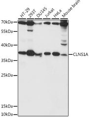 CLNS1A Rabbit pAb