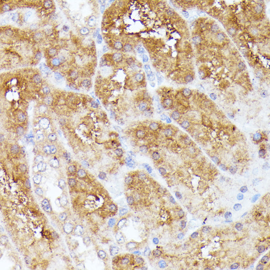 CLNS1A Rabbit pAb