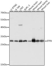 ETFB Rabbit pAb