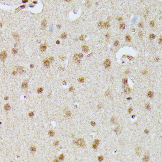 IGHMBP2 Rabbit pAb
