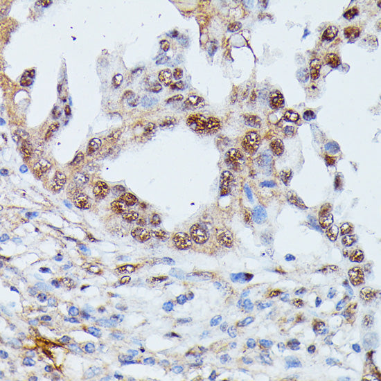 IGHMBP2 Rabbit pAb