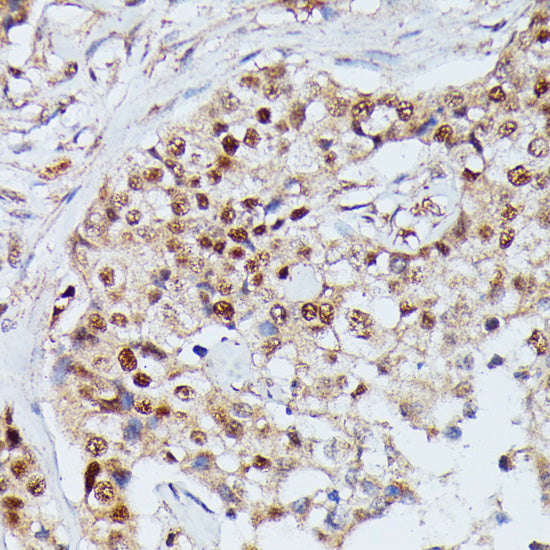 IGHMBP2 Rabbit pAb