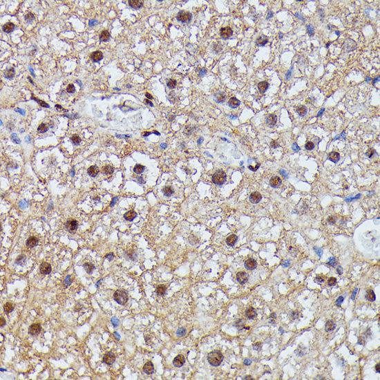 IGHMBP2 Rabbit pAb