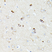 CCDC6 Rabbit pAb