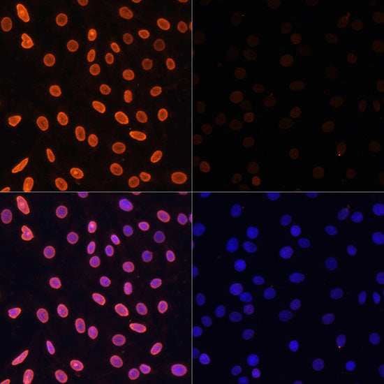 Acetyl-Histone H3-K36 Rabbit pAb