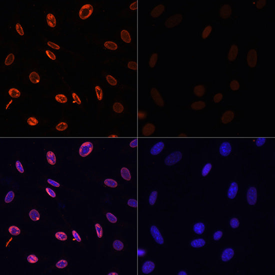 Acetyl-Histone H3-K36 Rabbit pAb