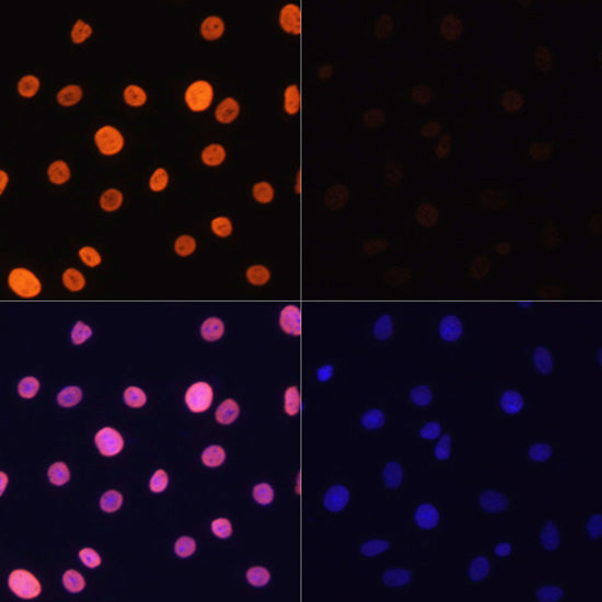 Acetyl-Histone H3-K4 Rabbit pAb