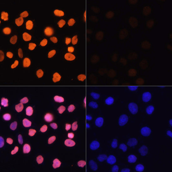 Acetyl-Histone H3-K4 Rabbit pAb